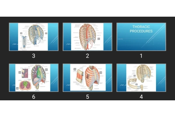 پاورپوینت THORACIC PROCEDURES