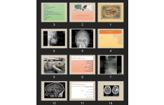 پاورپوینت Diagnostic tests