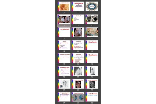 پاورپوینت Aortic Valve