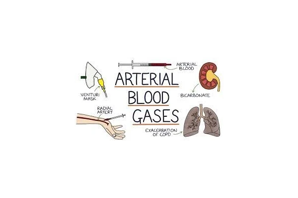 Arterial Blood Gas(گاز خون شریانی)