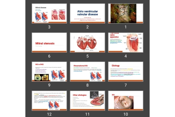 پاورپوینت بیماری دریچه میترال و تریکاسپ Atrio ventricular valvular disease
