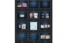 پاورپوینت Psoriatic Arthritis