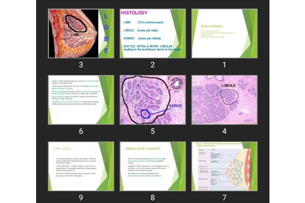 پاورپوینت Breast disease