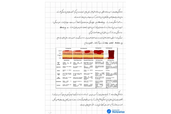 جزوه سوختگی