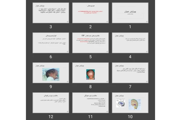 پاورپوینت هیدروسفالی