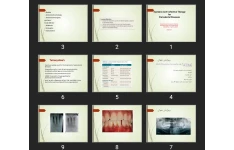 پاورپوینت Systemic Anti-infective Therapy for Periodontal Diseases