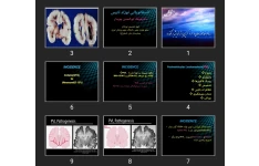 پاورپوینت انسفالوپاتی نوزاد نارس