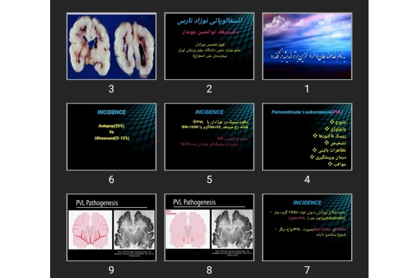 پاورپوینت انسفالوپاتی نوزاد نارس