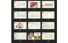 پاورپوینت Cirrhosis in adults Etiologies, clinical manifestations, diagnosis and complications