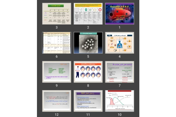 پاورپوینت هپاتیت حاد ویرال Hepatitis A-B & D Viruses