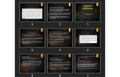 پاورپوینت Sjögren’s Syndrome