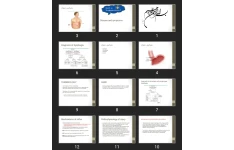 پاورپوینت Disease and symptoms