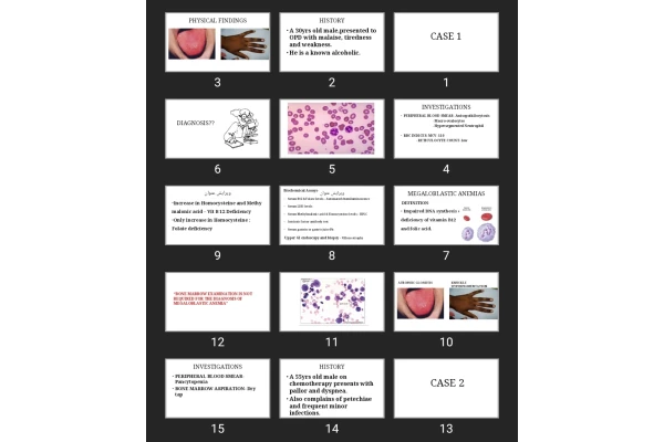 پاورپوینت Hematology case study