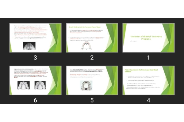 پاورپوینت Treatment of Skeletal Transverse Problems