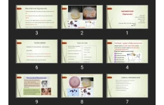 پاورپوینت MUCORMYCOSIS (Zygomycosis)