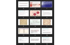 پاورپوینت Disorders of Hemostasis