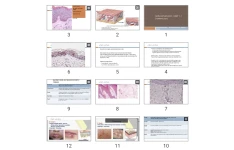 پاورپوینت Skin Pathology , part 1-1 (terminology)