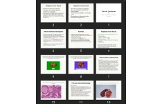 پاورپوینت Thyroid Neoplasms