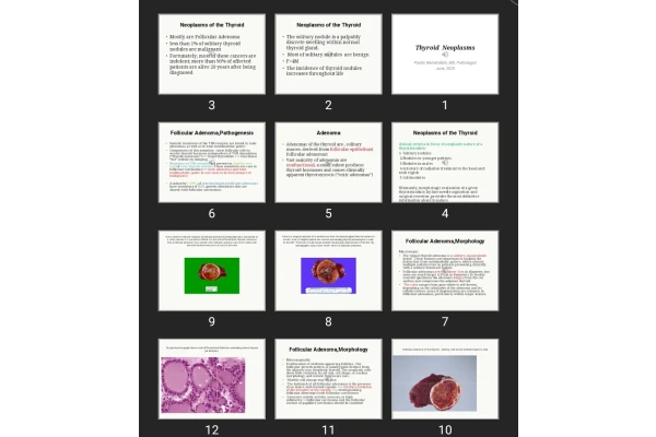 پاورپوینت Thyroid Neoplasms