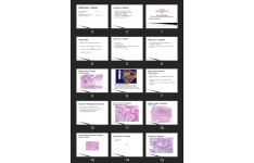 پاورپوینت PATHOLOGY FEMALE GENITAL SYSTEM Part 4
