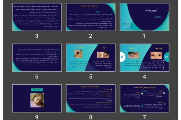 پاورپوینت تومور چشم
