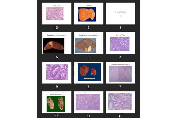 پاورپوینت Gross pathology