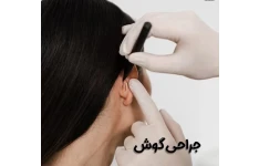 جزوه جراحی گوش دکتر موسوی - دست نویس