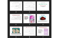 پاورپوینت Liver and Biliary Tract Tumors