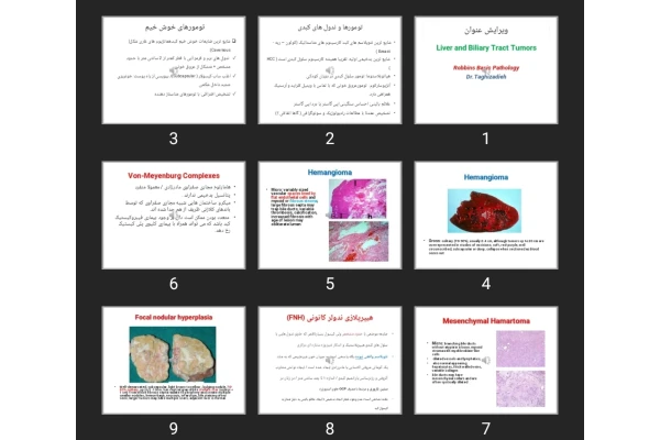 پاورپوینت Liver and Biliary Tract Tumors