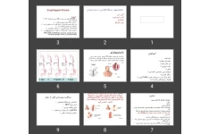 پاورپوینت ناهنجاری های دستگاه گوارش در دوره نوزادی آترزی مری آنوس ایمپر فوره آمفالوسل فتق دیافراگم