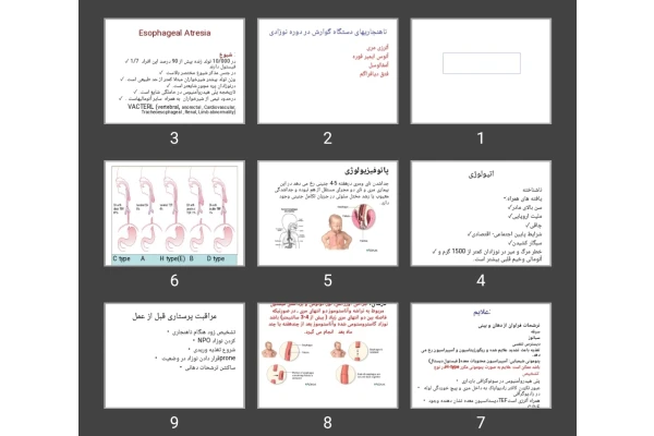 پاورپوینت ناهنجاری های دستگاه گوارش در دوره نوزادی آترزی مری آنوس ایمپر فوره آمفالوسل فتق دیافراگم