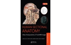 Human sectional anatomy : atlas of body sections, CT and MRI images-کتاب انگلیسی