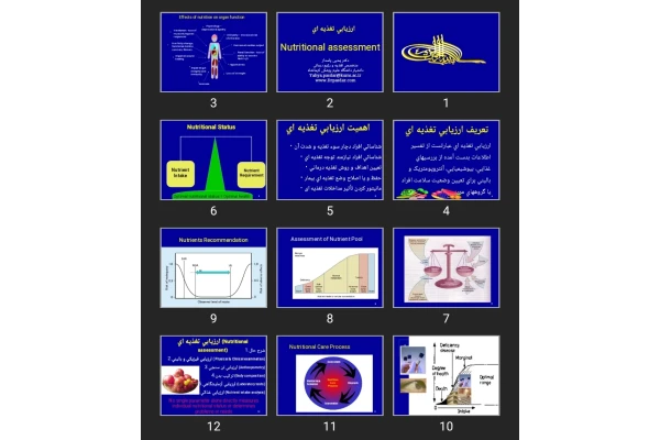 پاورپوینت ارزيابی تغذيه ای Nutritional assessment