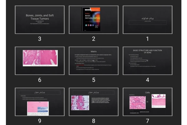 پاورپوینت Bones, Joints, and Soft Tissue Tumors