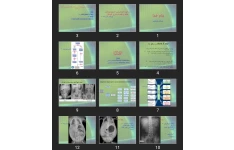 پاورپوینت برخورد تشخیصی تصویربرداری شکم و قفسه صدری کودکان
