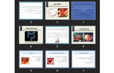 پاورپوینت مدیریت بیماران مبتلا به اختلالات روده و راست روده (پیچ خوردگی و انواژیناسیون روده، کانسر روده و اختلالات آنورکتوم)