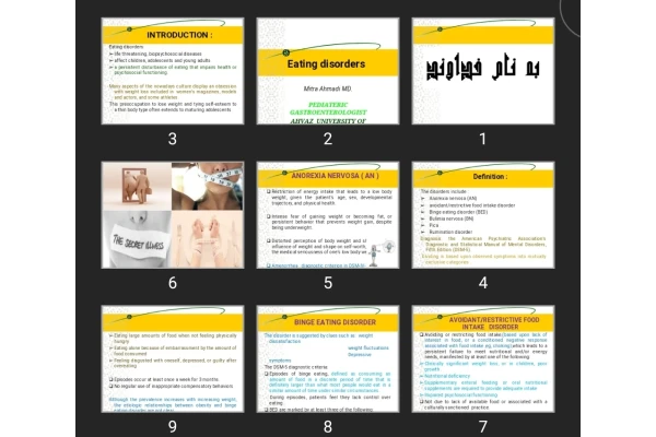 پاورپوینت Eating disorders