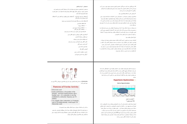 جزوه دیستوشی – لیبر غیر طبیعی