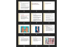 پاورپوینت Gout and Othercrystal-Associated Arthropathies