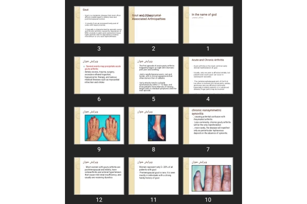 پاورپوینت Gout and Othercrystal-Associated Arthropathies