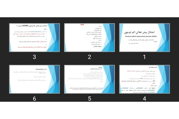 پاورپوینت اختلال بيش فعالی-كم توجهی