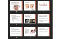 پاورپوینت Splenomegaly Lymphadenopathy Thrombocytopenia