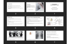 پاورپوینت RECOGNIZING OTHER DISEASE OF CHEST