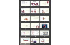 پاورپوینت Ventricular Aneurysm و اختلال دریچه