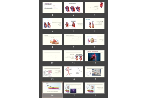 پاورپوینت Ventricular Aneurysm و اختلال دریچه