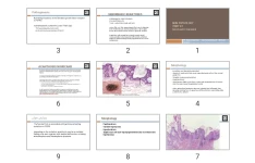 پاورپوینت Skin Pathology  part 2-1 (Neoplastic diseases)