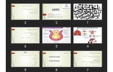 پاورپوینت ARDS