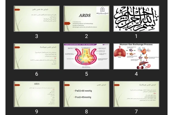پاورپوینت ARDS