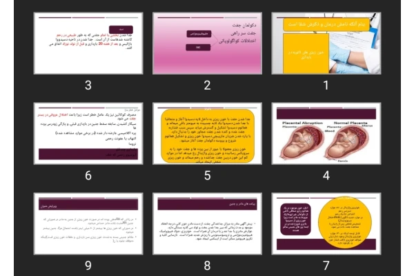 پاورپوینت خون ریزی های ثانویه در بارداری