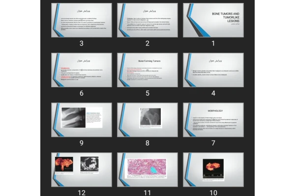 پاورپوینت BONE TUMORS AND TUMORLIKE LESIONS